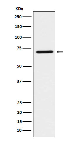 Anti-HNF1 beta Rabbit Monoclonal Antibody Boster Bio