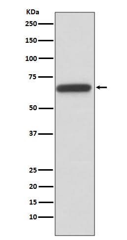 Anti-HNF1 beta Rabbit Monoclonal Antibody Boster Bio