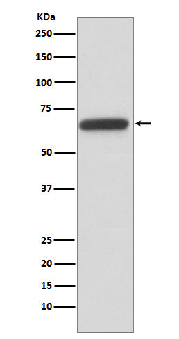 Anti-HNF1 beta Rabbit Monoclonal Antibody Boster Bio
