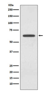 Anti-Glutaminase GLS Rabbit Monoclonal Antibody Boster Bio