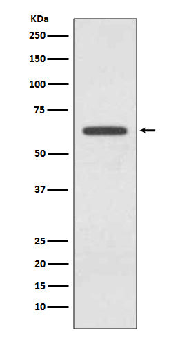 Anti-Glutaminase GLS Rabbit Monoclonal Antibody Boster Bio