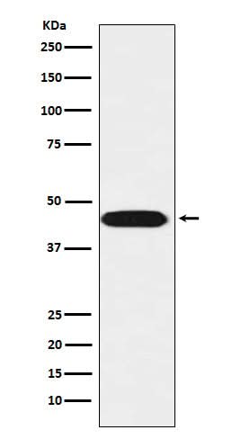 Anti-LIS1 Rabbit Monoclonal Antibody Boster Bio