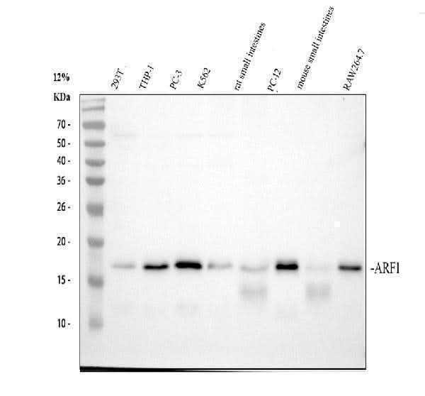 Anti-ARF1 Rabbit Monoclonal Antibody Boster Bio