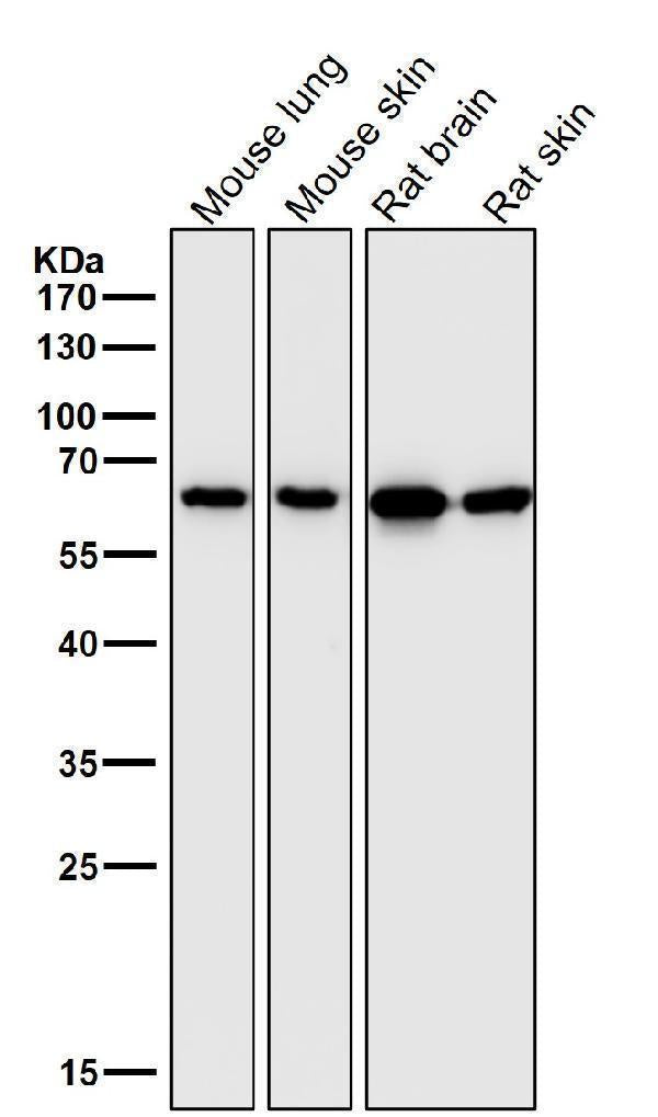 Anti-Hsp60 HSPD1 Rabbit Monoclonal Antibody Boster Bio