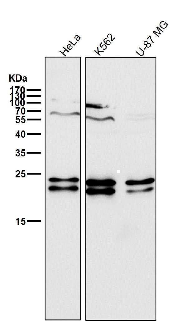 Anti-CD81 Rabbit Monoclonal Antibody Boster Bio