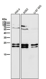 Anti-CD81 Rabbit Monoclonal Antibody Boster Bio