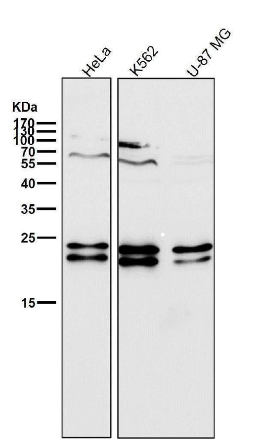 Anti-CD81 Rabbit Monoclonal Antibody Boster Bio