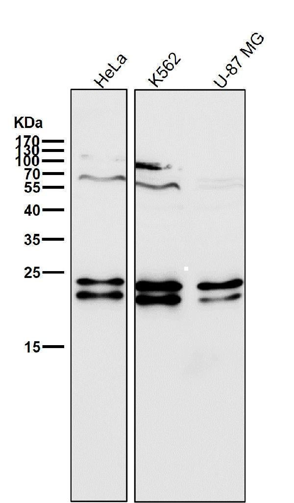Anti-CD81 Rabbit Monoclonal Antibody Boster Bio