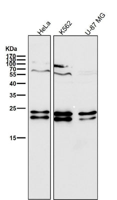 Anti-CD81 Rabbit Monoclonal Antibody Boster Bio