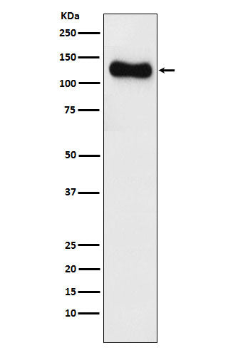Anti-SAP97 Rabbit Monoclonal Antibody Boster Bio