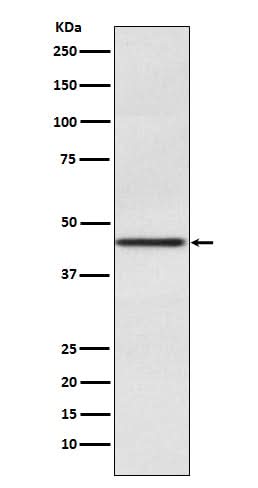 Anti-Pax2 Rabbit Monoclonal Antibody Boster Bio