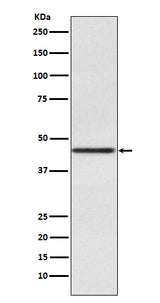 Anti-Pax2 Rabbit Monoclonal Antibody Boster Bio
