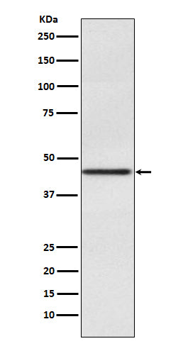 Anti-Pax2 Rabbit Monoclonal Antibody Boster Bio