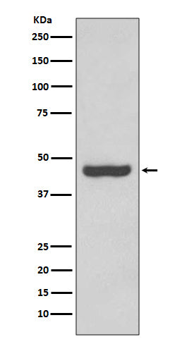 Anti-PAX2 Rabbit Monoclonal Antibody Boster Bio