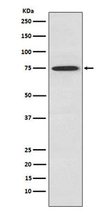 Anti-PKC theta Rabbit Monoclonal Antibody Boster Bio