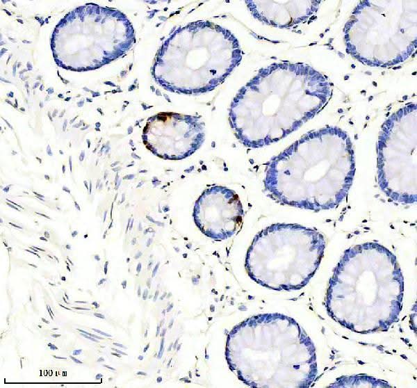 Anti-Somatostatin 28 Rabbit Monoclonal Antibody Boster Bio