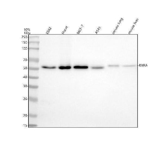 Anti-Retinoid X Receptor alpha Rabbit Monoclonal Antibody Boster Bio