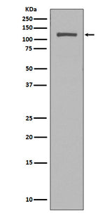 Anti-NUP98 Rabbit Monoclonal Antibody Boster Bio