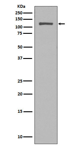 Anti-NUP98 Rabbit Monoclonal Antibody Boster Bio