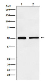 Anti-TIM1 HAVCR1 Monoclonal Antibody Boster Bio