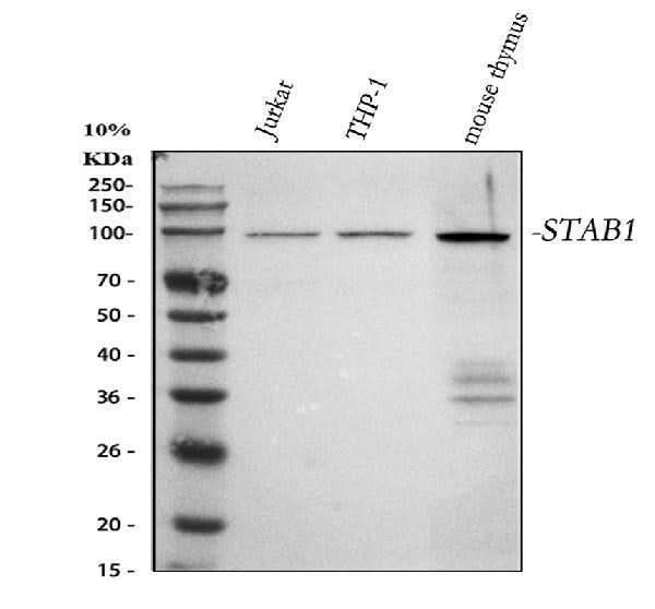 Anti-SATB1 Rabbit Monoclonal Antibody Boster Bio