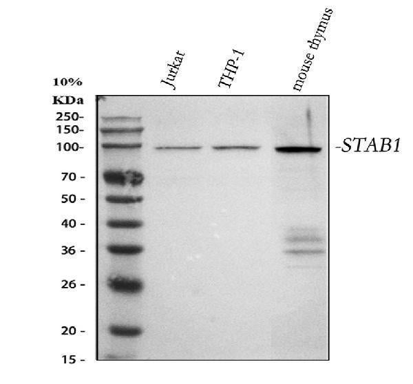 Anti-SATB1 Rabbit Monoclonal Antibody Boster Bio