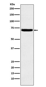 Anti-Heparanase 1 HPSE Monoclonal Antibody Boster Bio