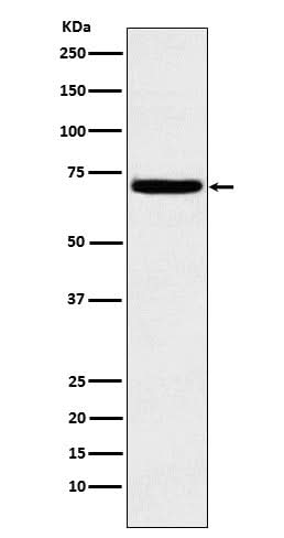 Anti-Heparanase 1 HPSE Monoclonal Antibody Boster Bio