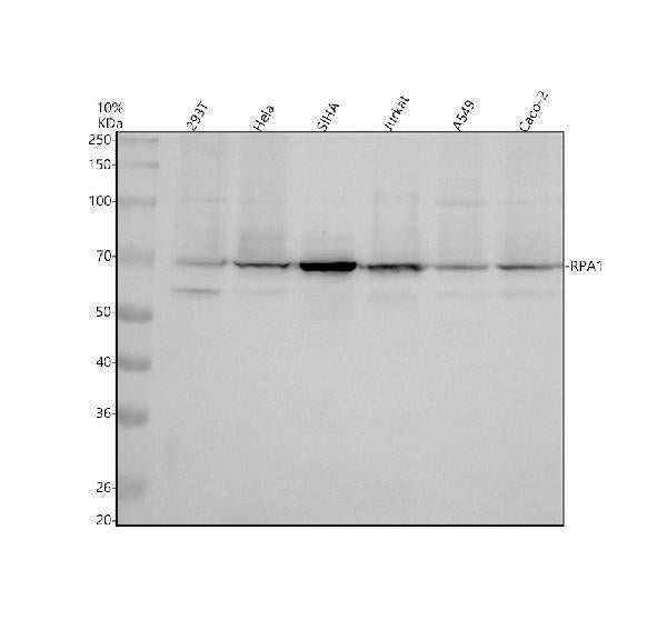 Anti-RPA70 Monoclonal Antibody Boster Bio