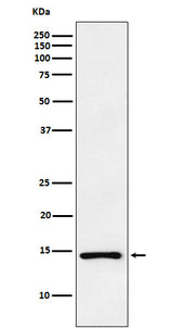 Anti-ANP NPPA Monoclonal Antibody Boster Bio