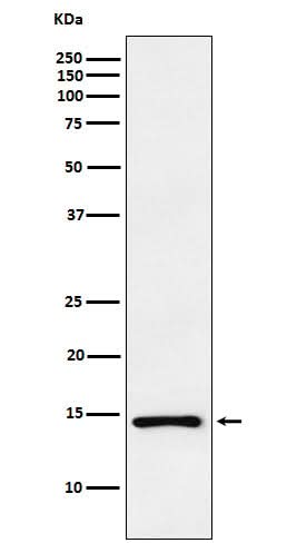 Anti-ANP NPPA Monoclonal Antibody Boster Bio