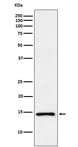 Anti-ANP NPPA Monoclonal Antibody Boster Bio