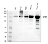 Anti-CPS1 Monoclonal Antibody Boster Bio