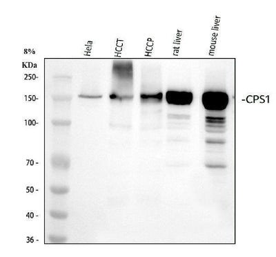 Anti-CPS1 Monoclonal Antibody Boster Bio