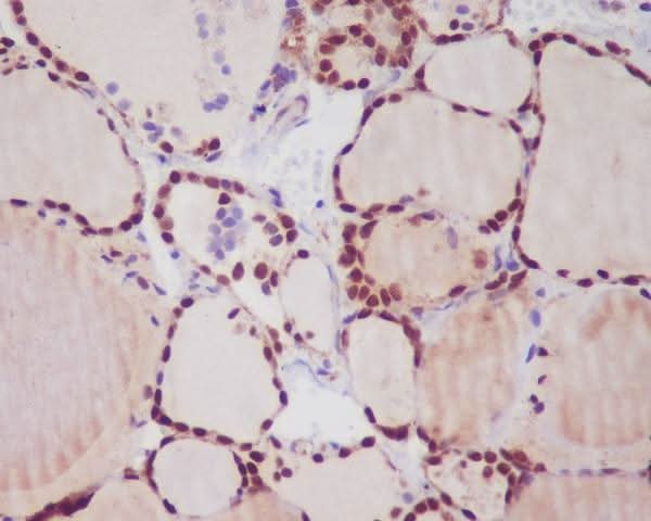 Anti-TTF1 NKX2-1 Rabbit Monoclonal Antibody Boster Bio