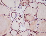 Anti-TTF1 NKX2-1 Rabbit Monoclonal Antibody Boster Bio