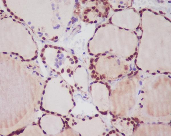 Anti-TTF1 NKX2-1 Rabbit Monoclonal Antibody Boster Bio
