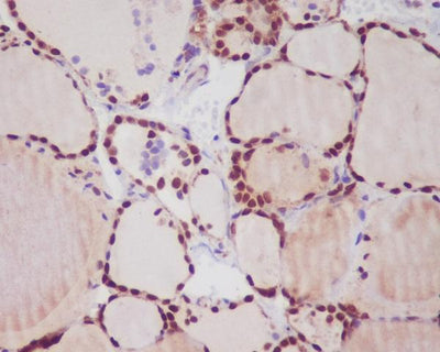 Anti-TTF1 NKX2-1 Rabbit Monoclonal Antibody Boster Bio