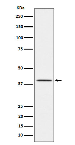 Anti-TTF1 Rabbit Monoclonal Antibody Boster Bio