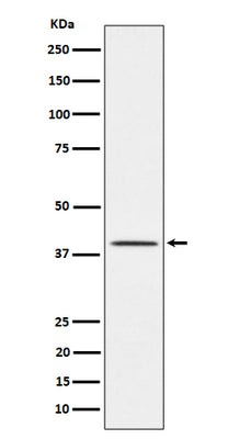 Anti-TTF1 Rabbit Monoclonal Antibody Boster Bio