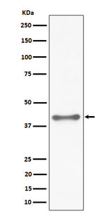 Anti-TTF1 Rabbit Monoclonal Antibody Boster Bio