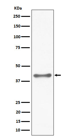 Anti-TTF1 Rabbit Monoclonal Antibody Boster Bio