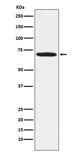 Anti-LIMK1 Rabbit Monoclonal Antibody Boster Bio