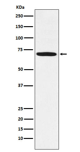 Anti-LIMK1 Rabbit Monoclonal Antibody Boster Bio