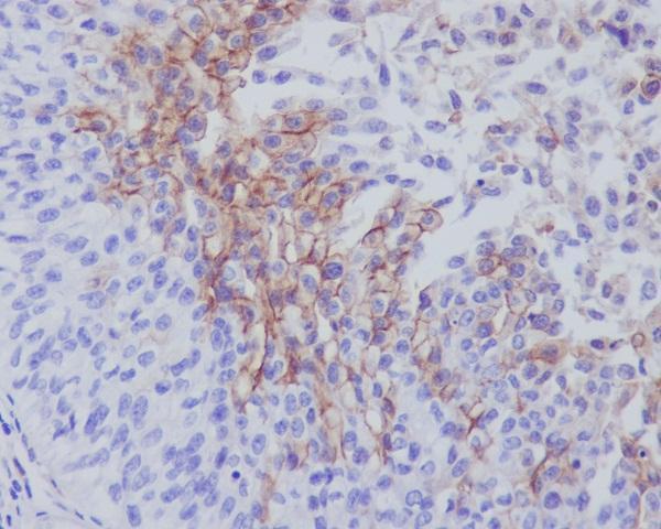 Anti-Thrombomodulin THBD Rabbit Monoclonal Antibody Boster Bio