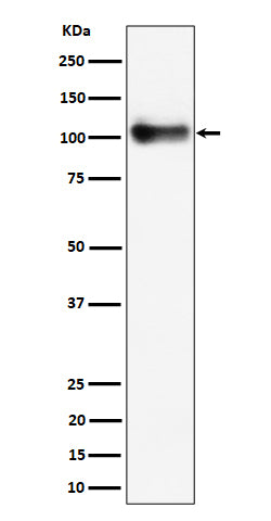 Anti-Thrombomodulin / CD141 Rabbit Monoclonal Antibody Boster Bio