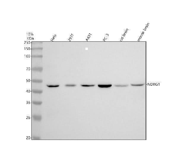 Anti-NDRG1 Monoclonal Antibody Boster Bio
