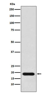 Anti-NM23 Rabbit Monoclonal Antibody Boster Bio