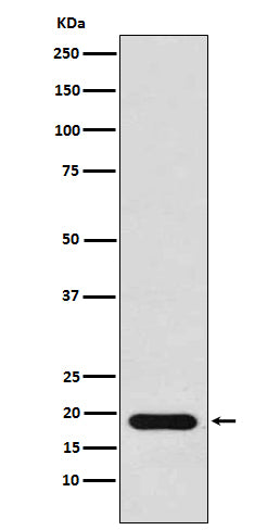 Anti-NM23 Rabbit Monoclonal Antibody Boster Bio