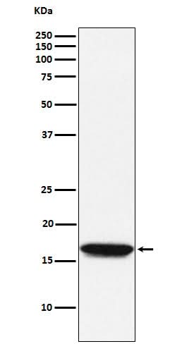 Anti-NM23A Monoclonal Antibody Boster Bio